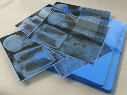 Синяя медицинская пленка для струйной печати